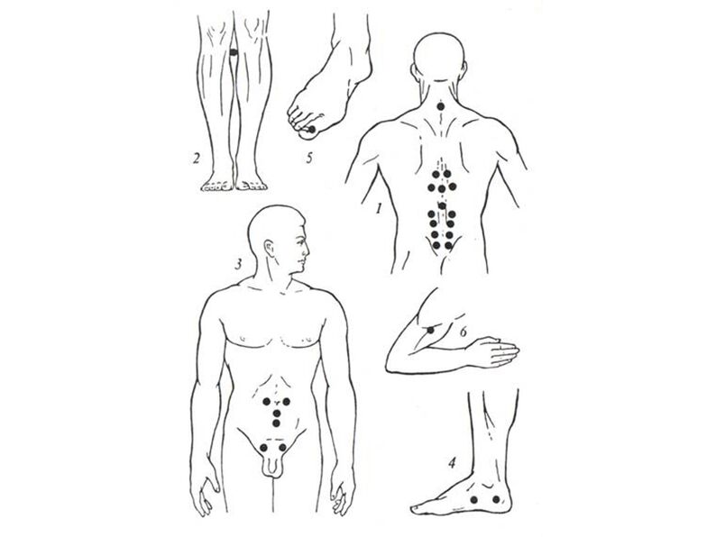 Acupuncture massage